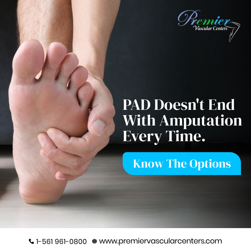 Peripheral Arterial Disease Treatment