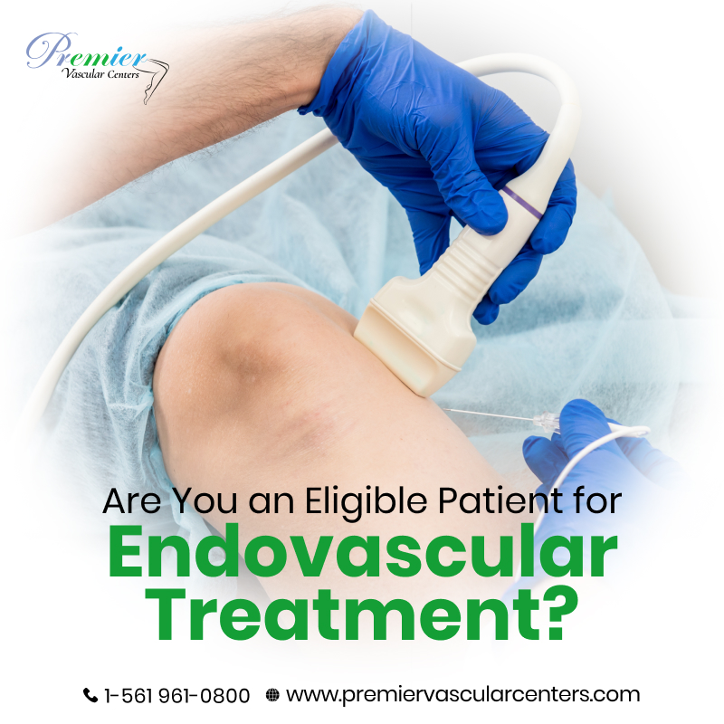 Endovascular Treatment Boca Raton