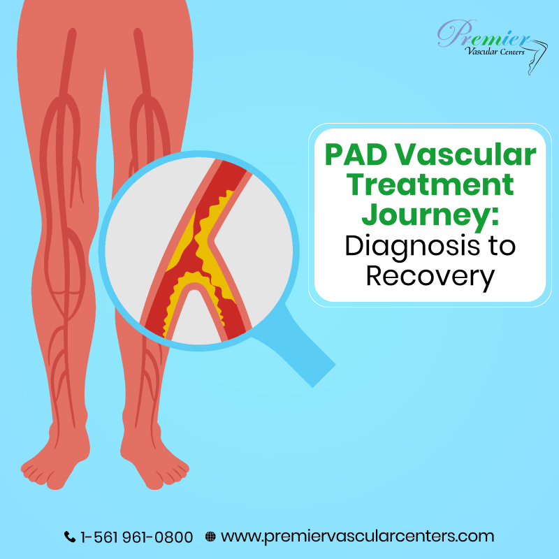 PAD Vascular Treatment Boca Raton