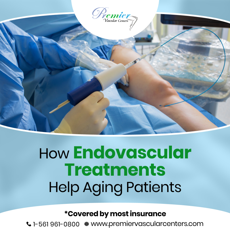Endovascular Treatment Boca Raton