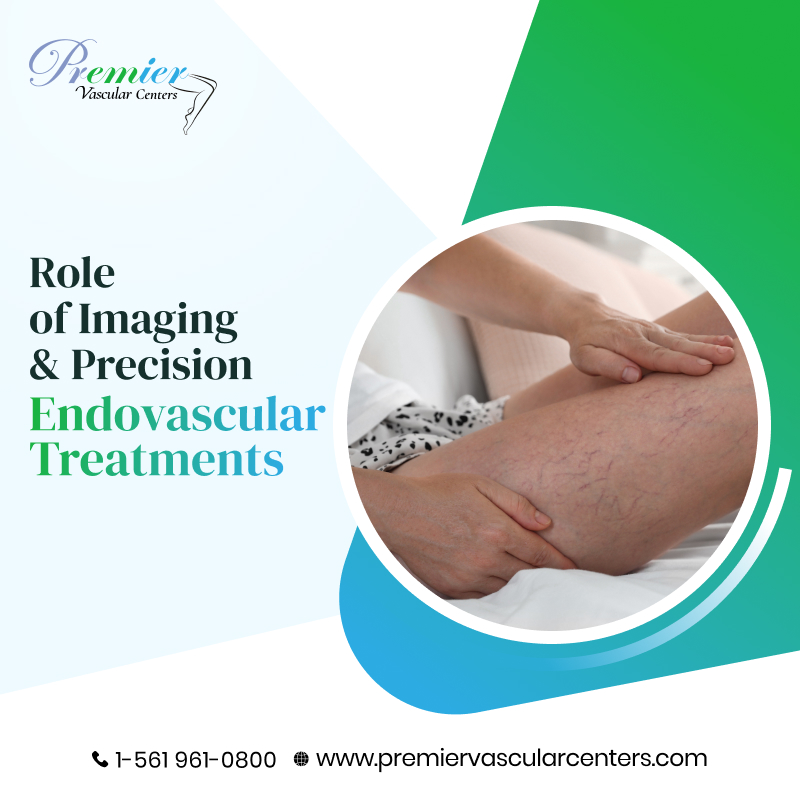 Endovascular Treatment Boca Raton