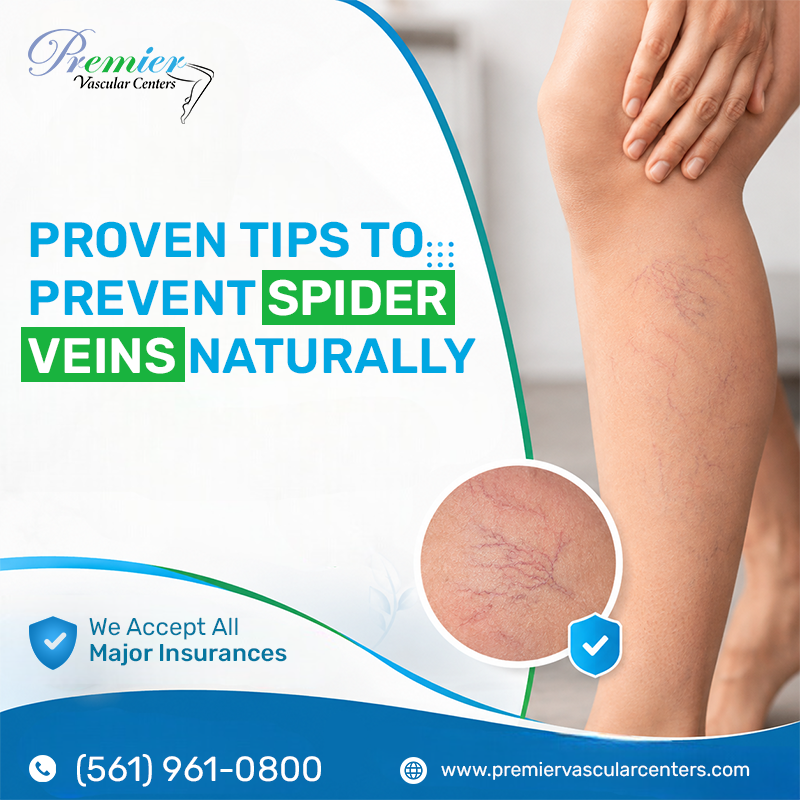 Spider Vein Removal Treatments