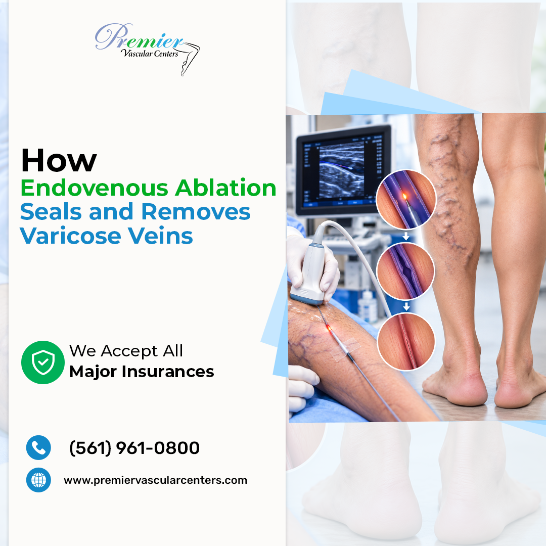 Cutting-edge Vein Treatments