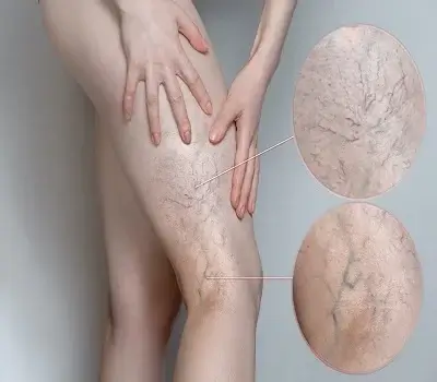 about-image